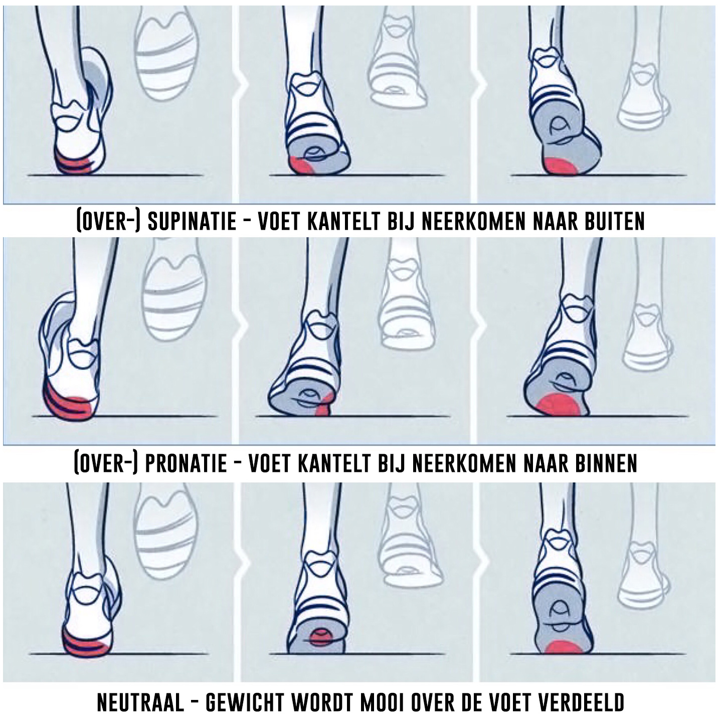 Supinatie; pronatie, neutraal - Sportline welke loopstijl heb je - Sportline
