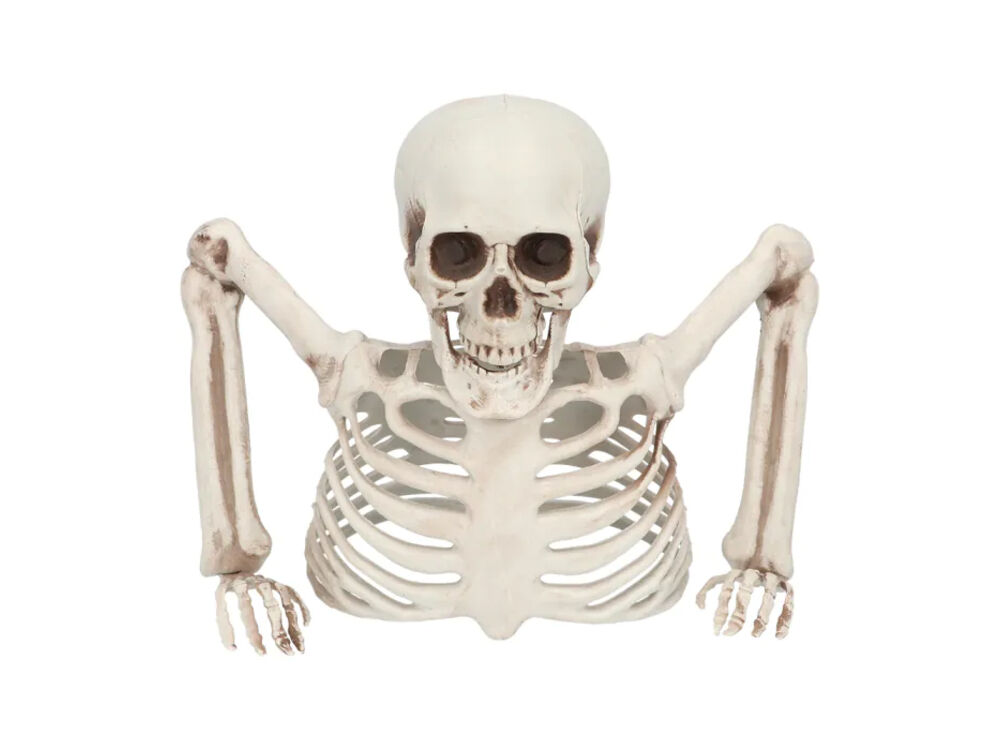 Overige