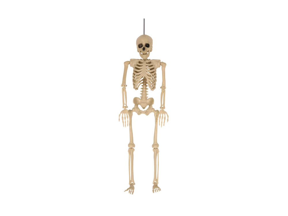 Overige