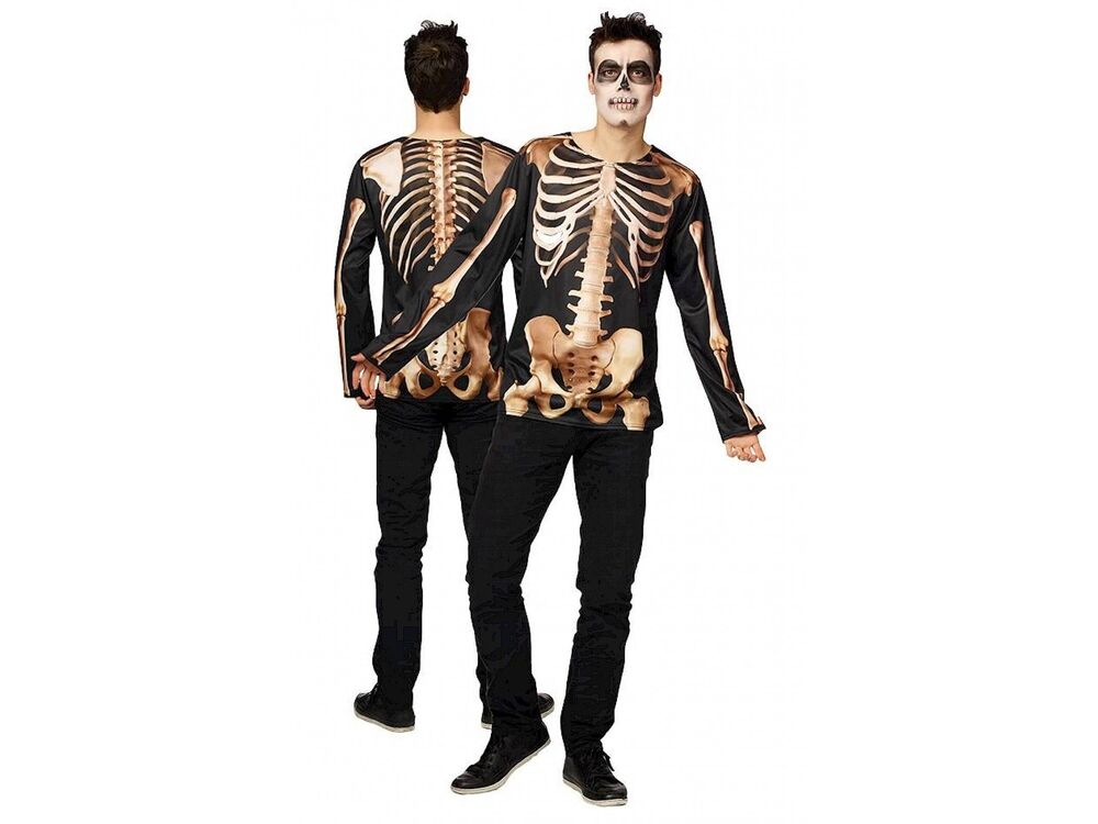 Overige