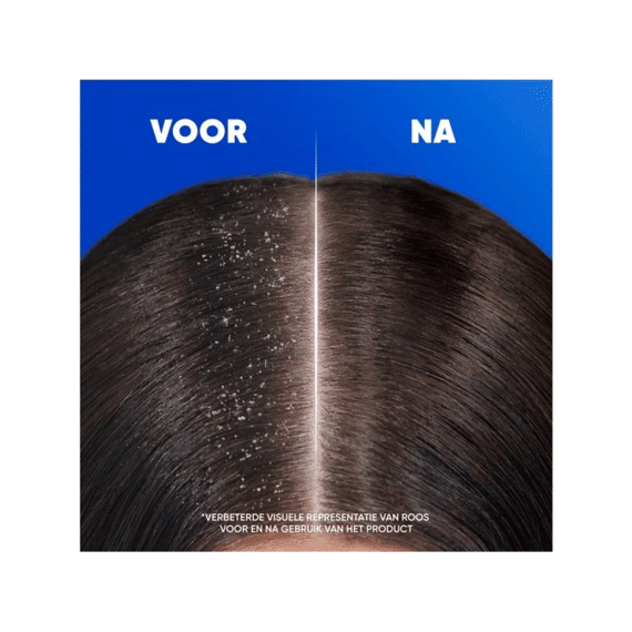 Head And Shoulders Shampoo 2 In 1 Citrus Fresh 300ml